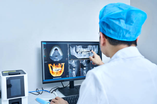 Best Emergency Root Canal Treatment in Hollister, CA